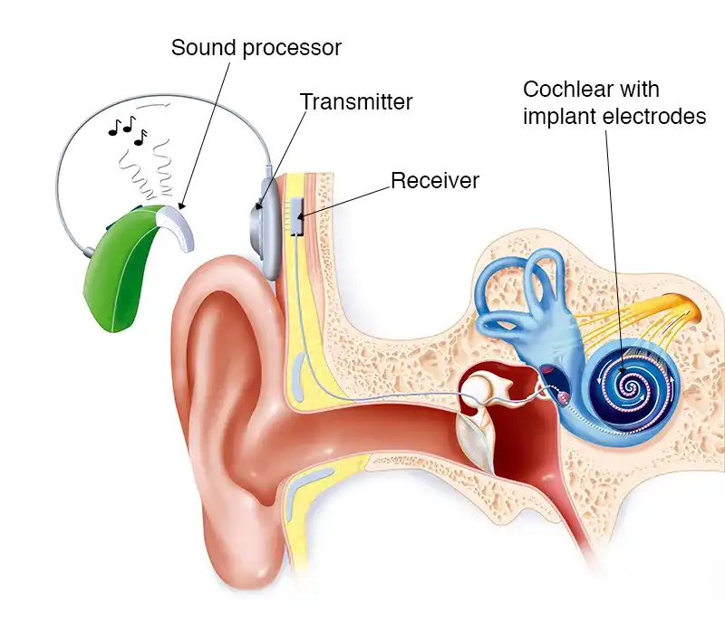 How Do Hearing Aids Work