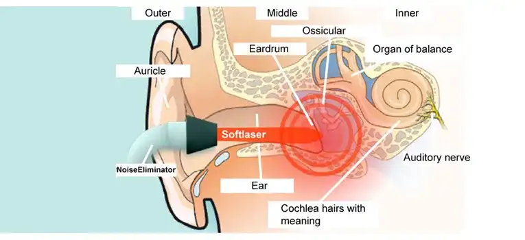 Can-Hearing-Aids-Help-Patient-with-Tinnitus Can Hearing Aids Help Patient with Tinnitus