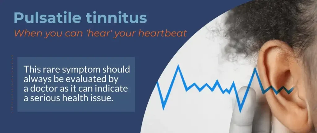 pulsatile tinnitus