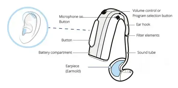 How BTE hearing aids work