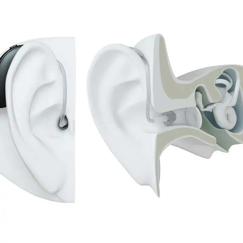 Main Body of the BTE Hearing Aid