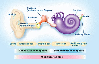 Hearing Loss Types Causes and Treatments Carolina Hearing Doctors